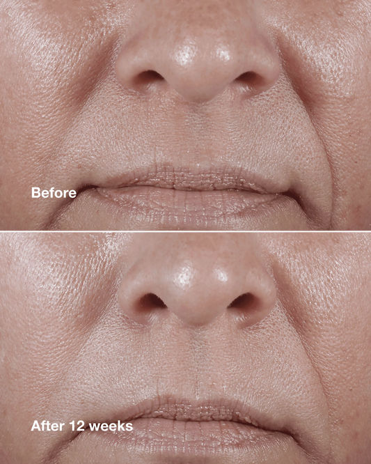 Clinique Smart Clinical Repair™ Wrinkle Correcting Rich Cream - US 9584