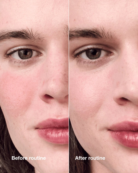 Redness Solutions Redness Regimen - US 0696
