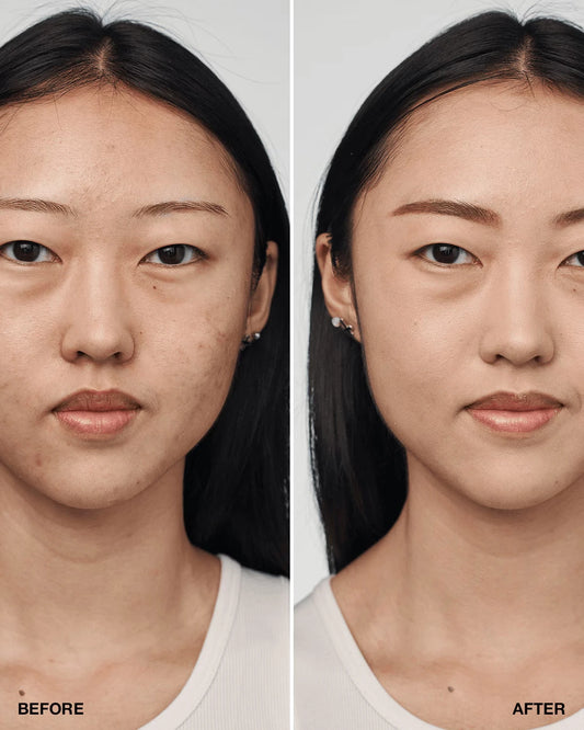 Even Better Clinical™ Serum Foundation Broad Spectrum SPF 25 - US 0214