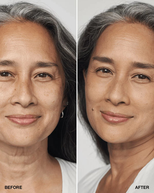 Even Better Clinical™ Serum Foundation Broad Spectrum SPF 25 - US 2983