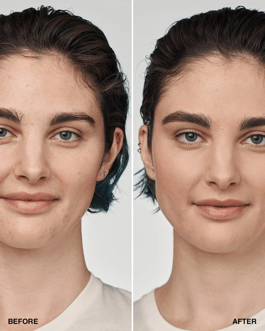 Even Better Clinical™ Serum Foundation Broad Spectrum SPF 25 - US 0656