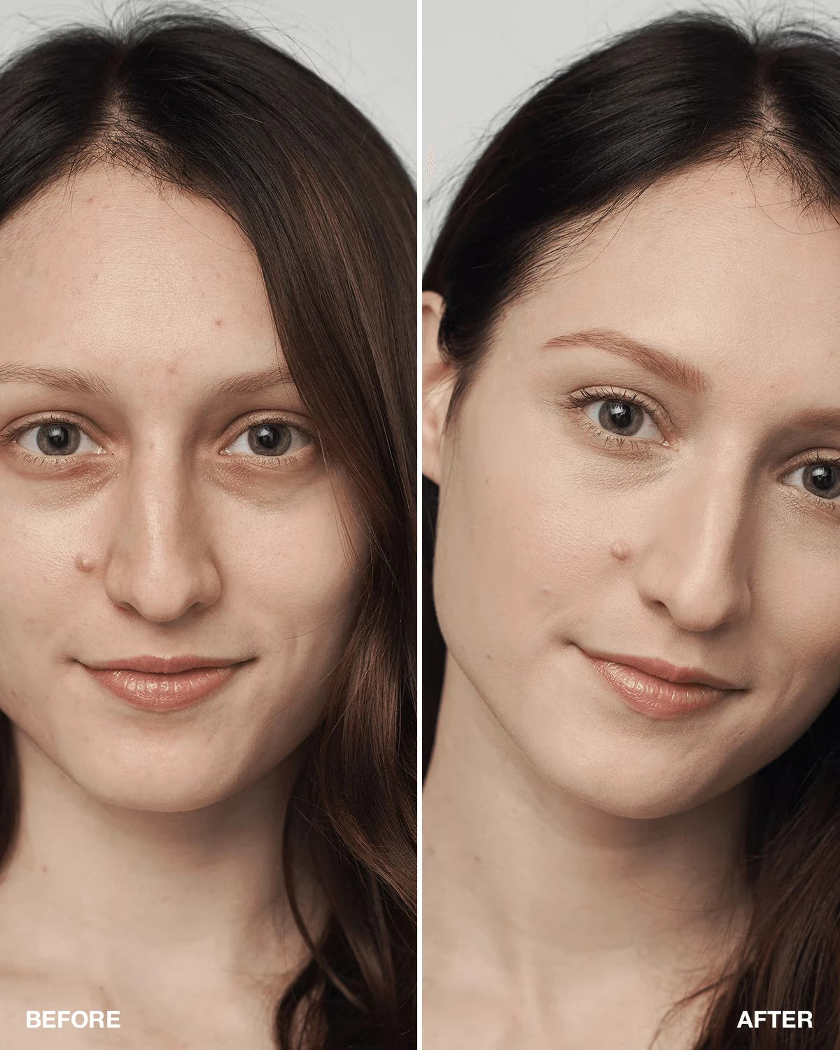 Even Better Clinical™ Serum Foundation Broad Spectrum SPF 25 - US 6281