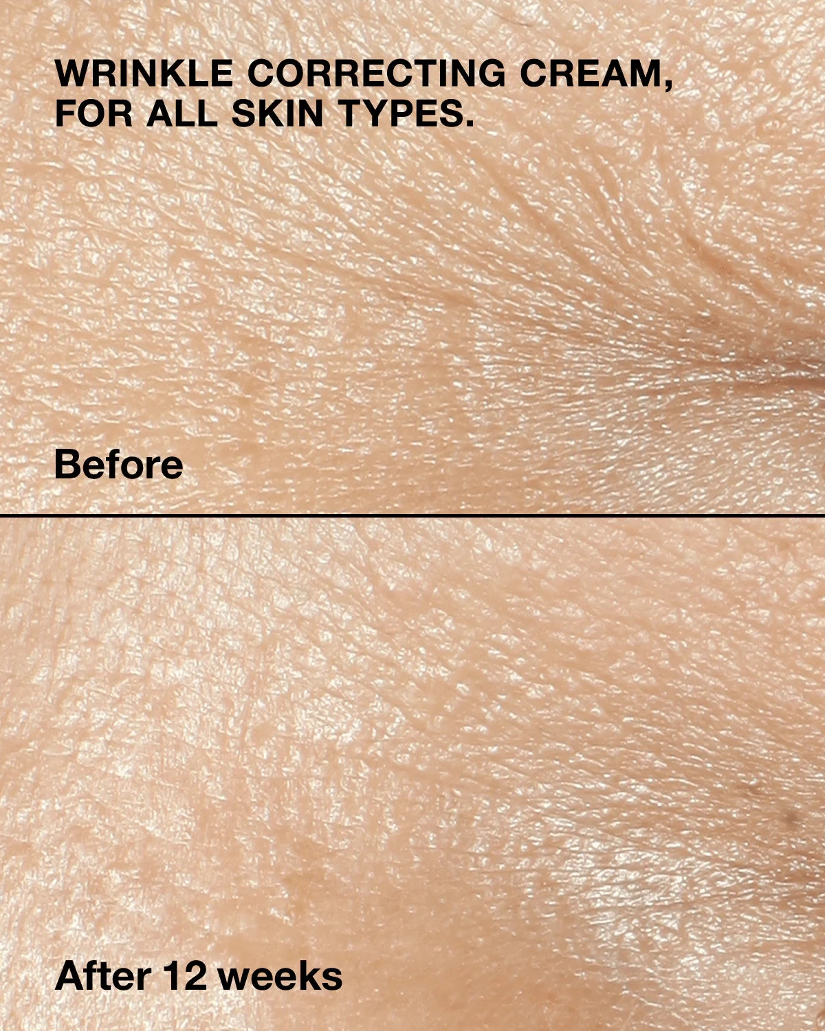 Clinique Smart Clinical Repair™ Wrinkle Correcting Cream - US 4390