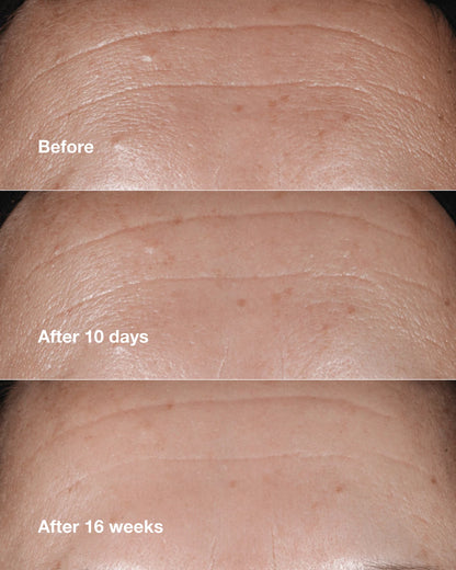 Anti-Aging Routine: Mini Smart Clinical Repair Kit - US 3094