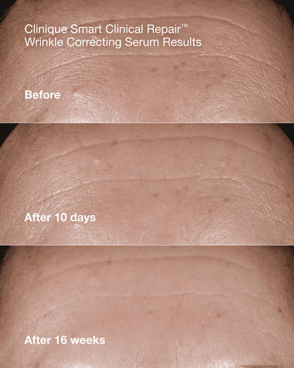 Anti-Aging Routine Skincare Set - US 3745