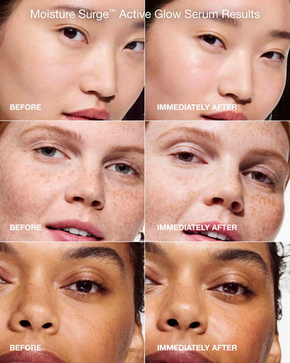 Moisture Surge™ Dewy Glow Power Pair - US 5570
