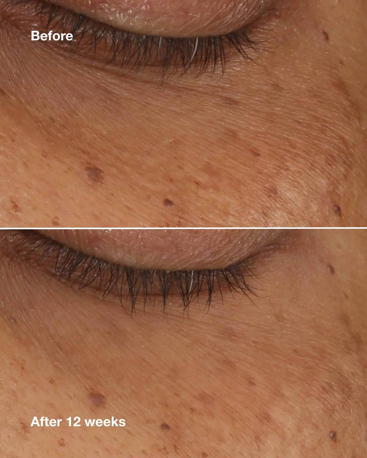 All About Eyes™ Brightening Serum Concentrate - US 9443