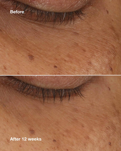 All About Eyes™ Brightening Serum Concentrate - US 9443