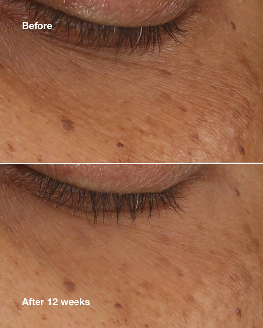 All About Eyes™ Brightening Serum Concentrate - US 9443