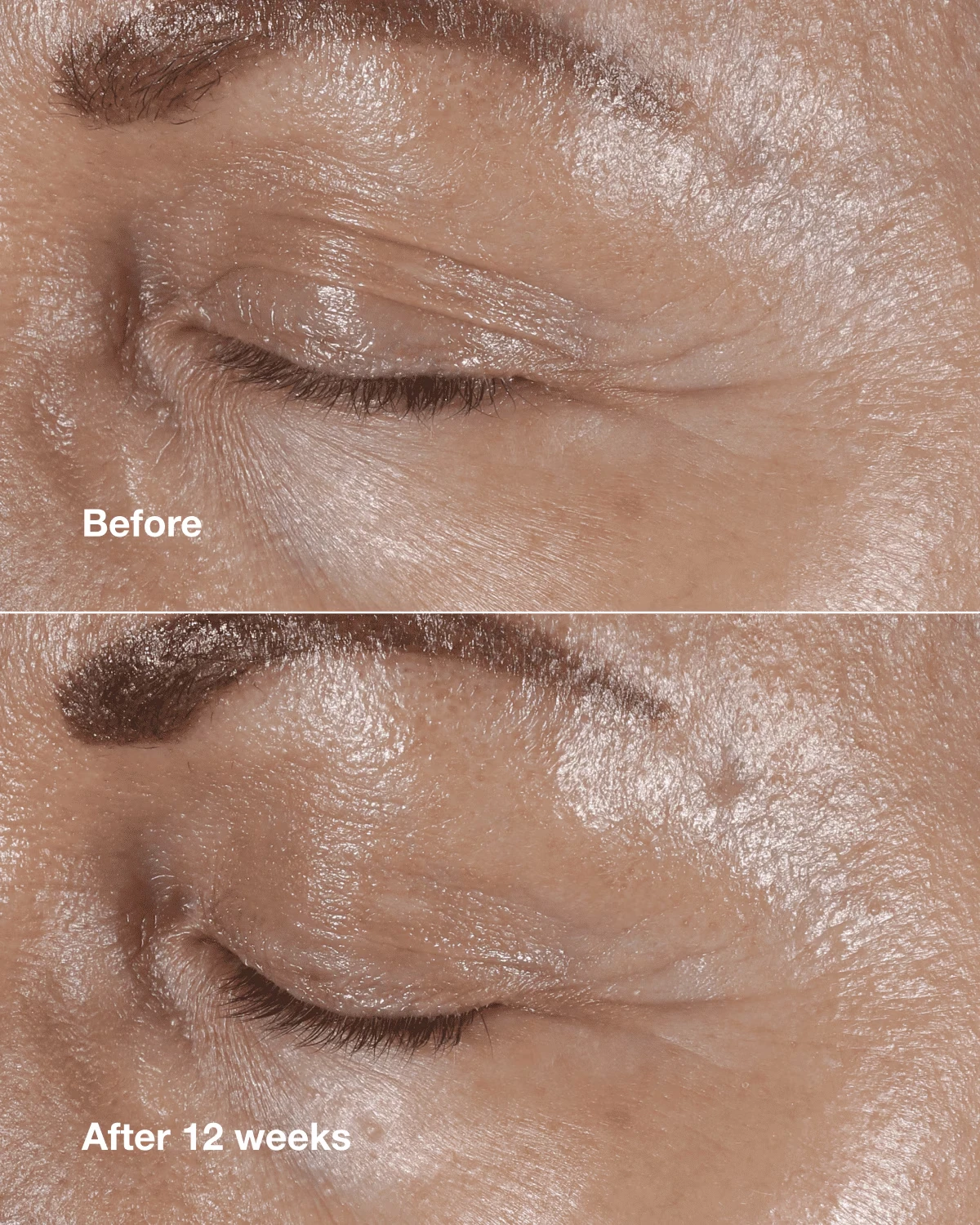 Clinique Smart Clinical Repair™ Wrinkle Correcting Eye Cream - US 7943