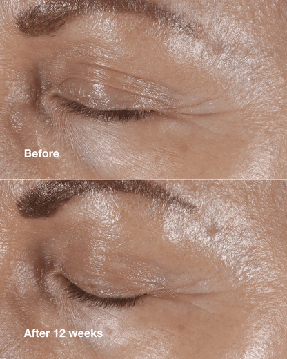 Clinique Smart Clinical Repair™ Wrinkle Correcting Eye Cream - US 7943