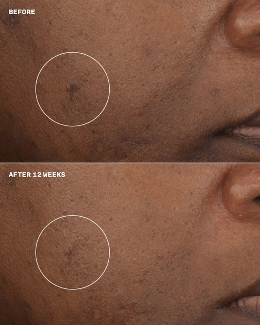 Even Better Clinical™ Brightening Moisturizer - US 3450
