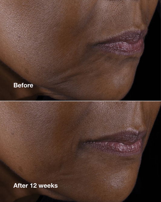Clinique Smart Clinical Repair™ Lifting Face + Neck Cream - US 7006
