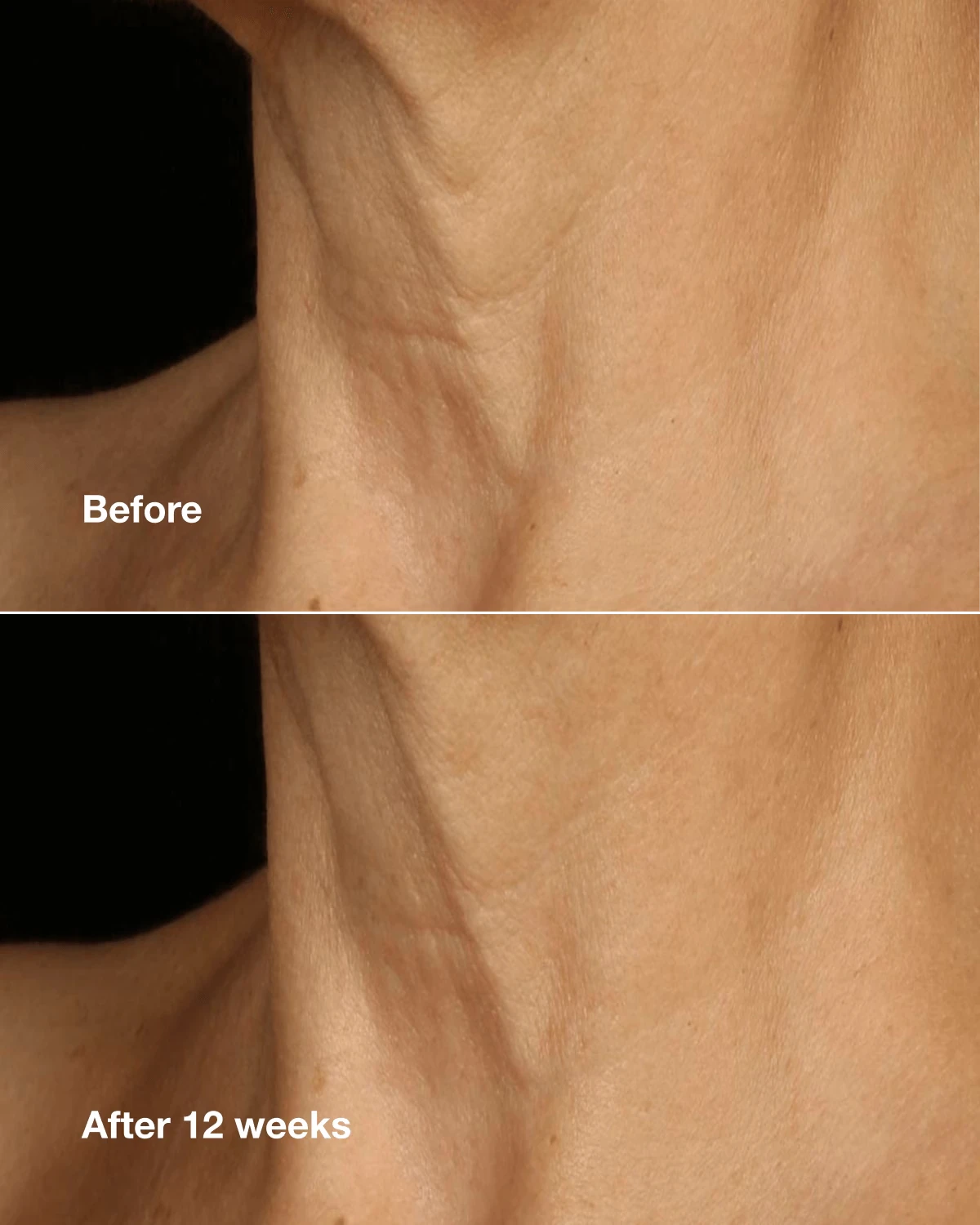 Clinique Smart Clinical Repair™ Lifting Face + Neck Cream - US 7006