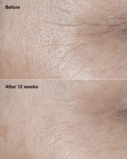 Clinique Smart Clinical Repair™ Broad Spectrum SPF 30 Wrinkle Correcting Cream - US 0562
