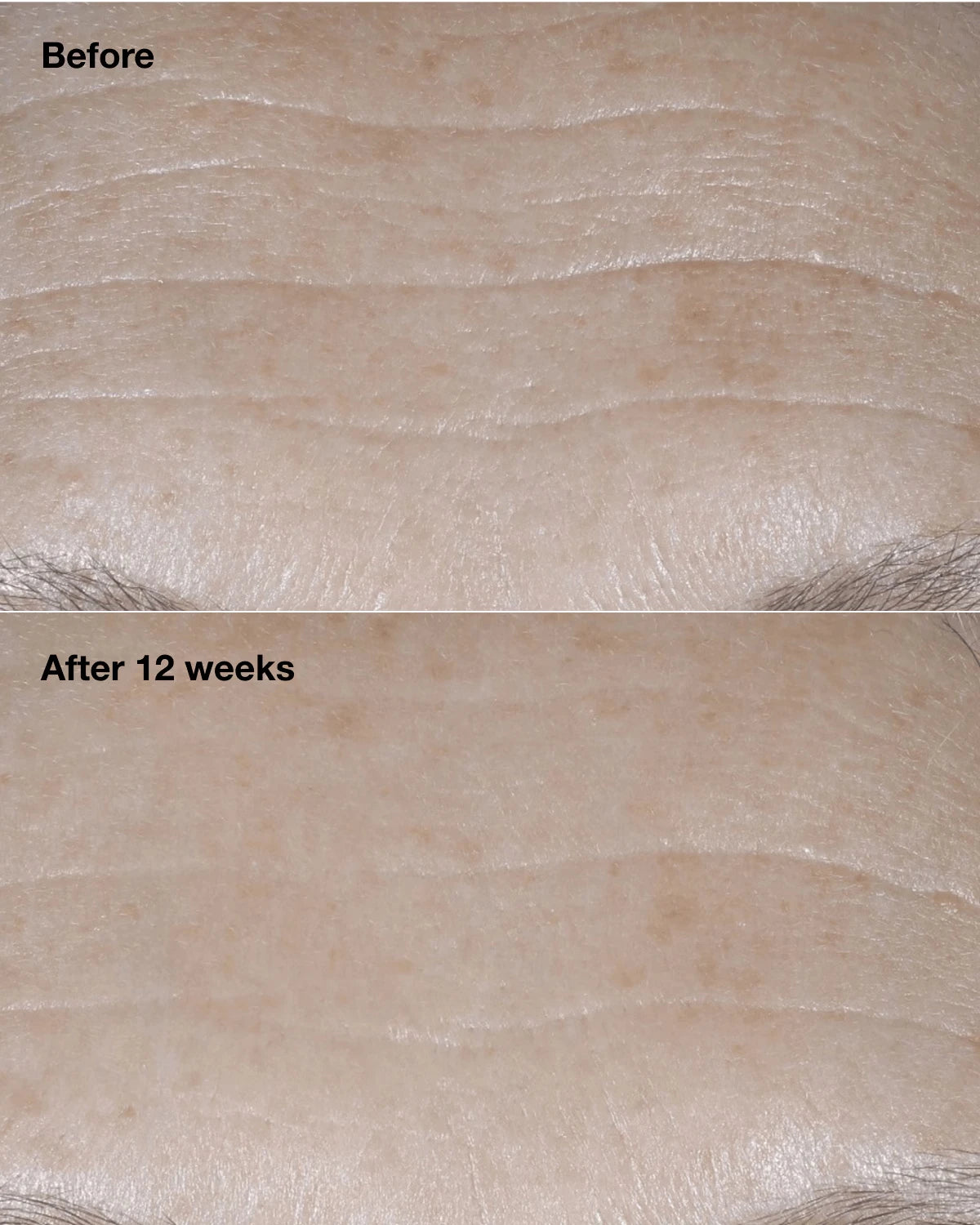 Clinique Smart Clinical Repair™ Broad Spectrum SPF 30 Wrinkle Correcting Cream - US 0562