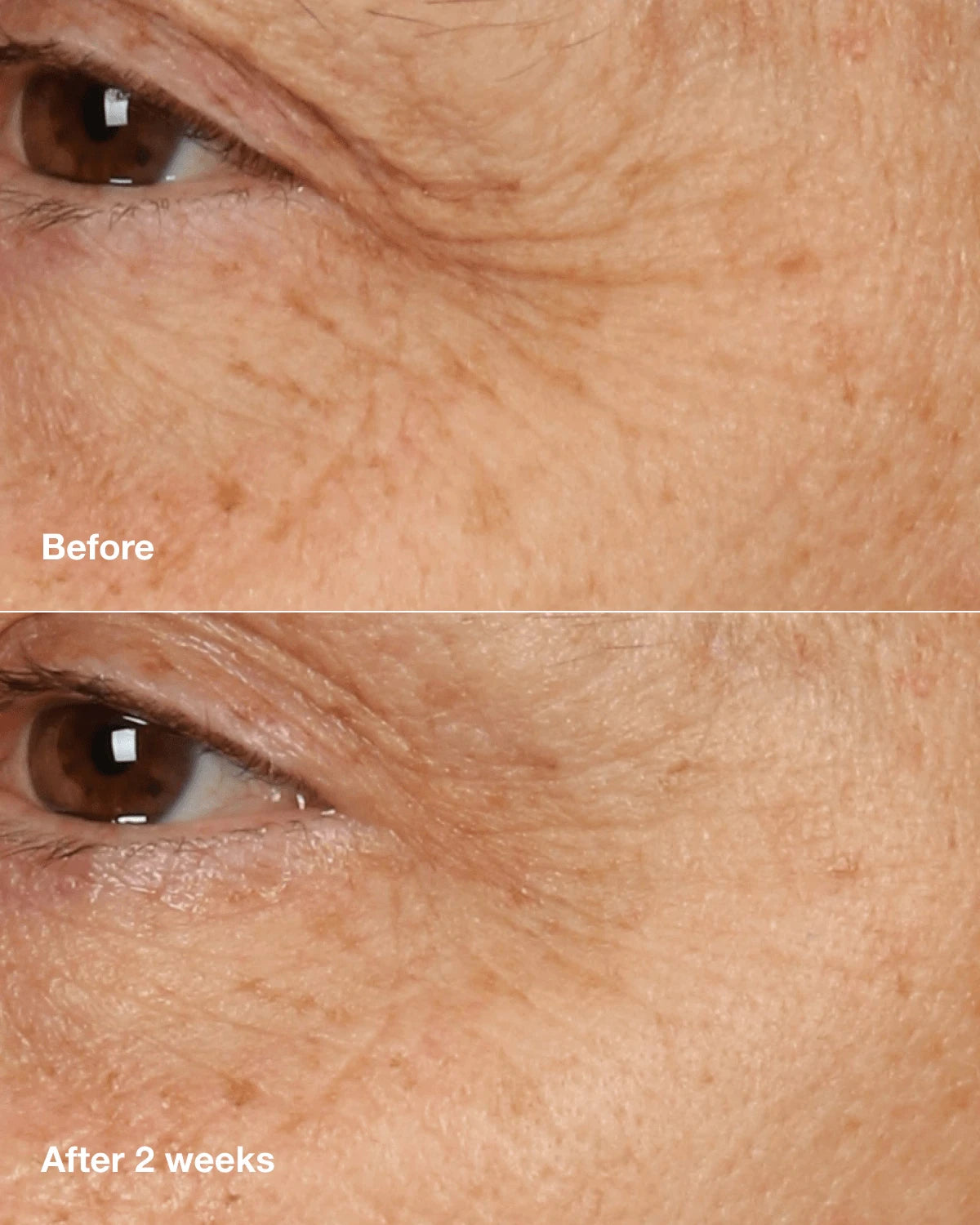 Clinique Smart Clinical Repair™ Overnight Recovery Cream + Mask - US 3270