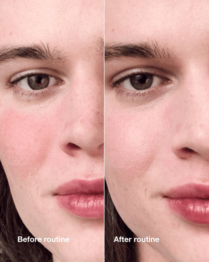 Redness Solutions Redness Regimen - US 7613