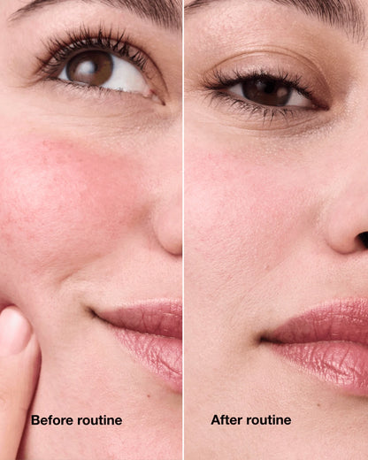 Redness Solutions Redness Regimen - US 0696