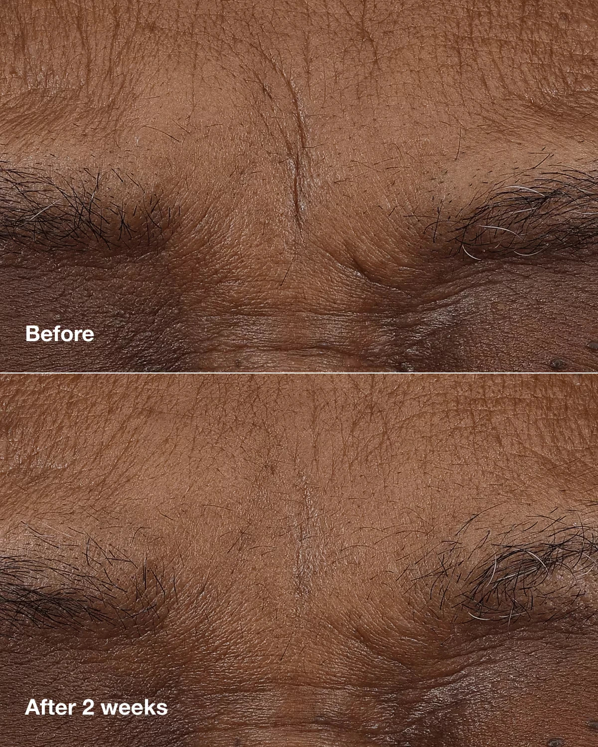 Clinique Smart Clinical Repair™ AM/PM Retinoid Balm - US 5310