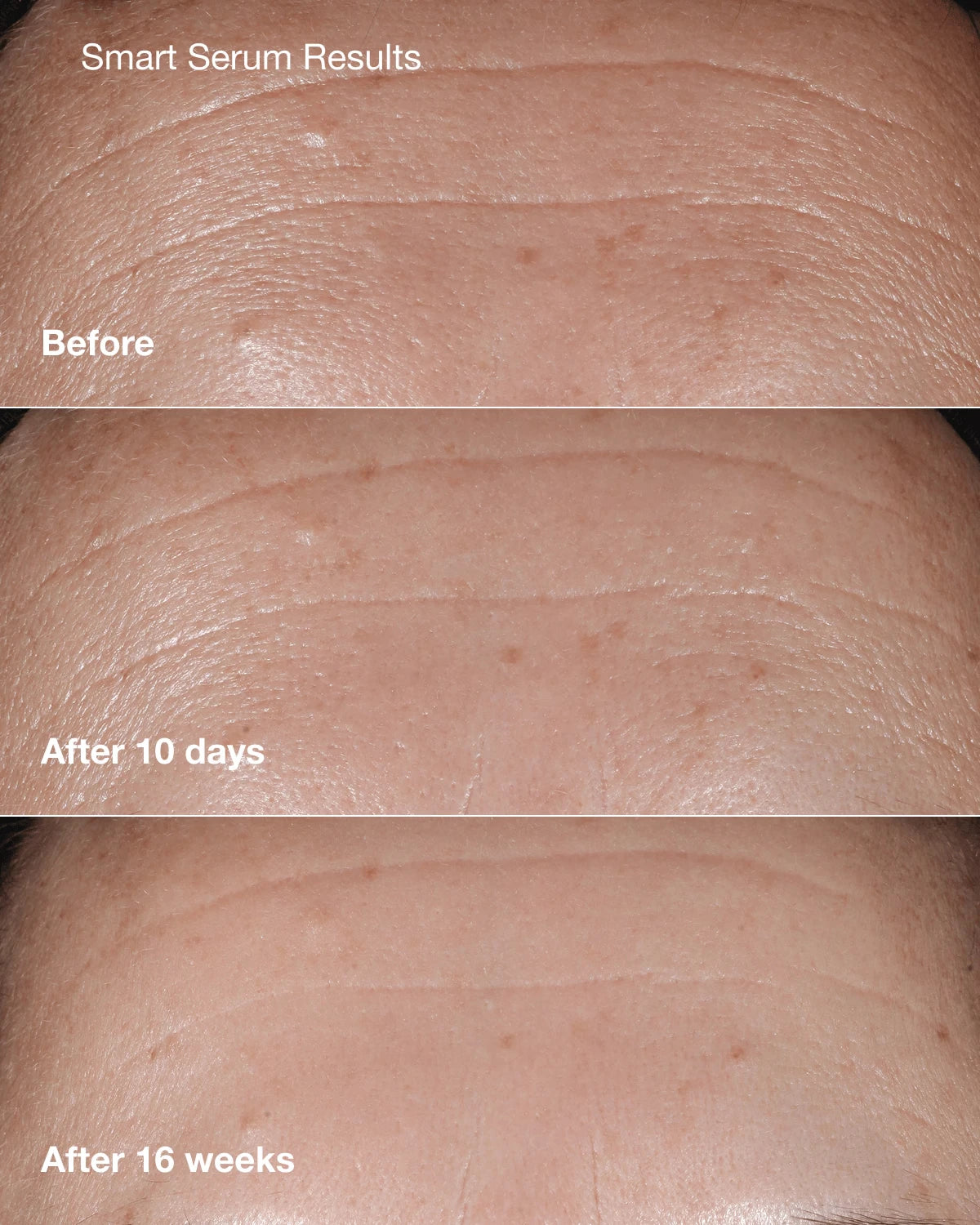 Anti-Aging Skincare Bundle - US 5033