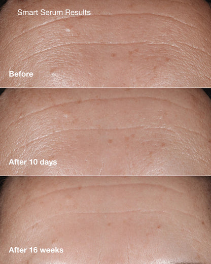Anti-Aging Skincare Bundle - US 5033