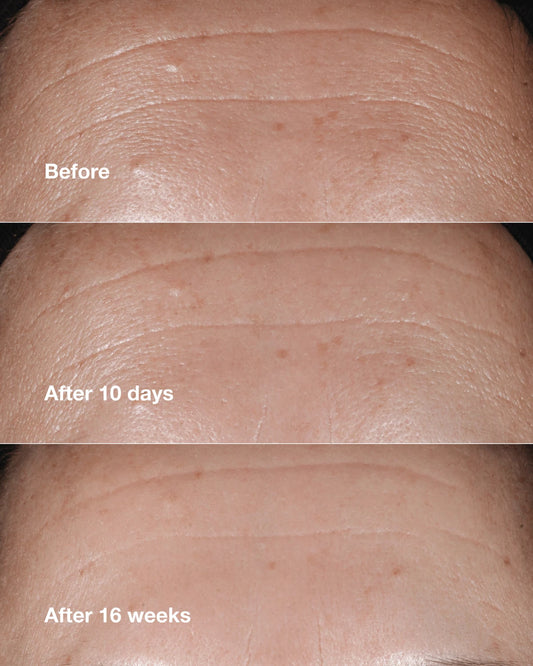 Clinique Smart Clinical Repair™ Wrinkle Correcting Serum - US 8116