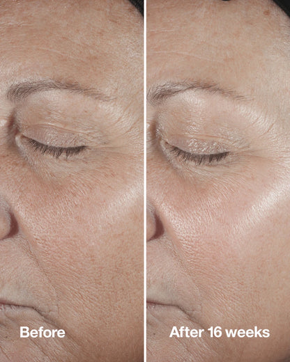 Clinique Smart Clinical Repair™ Wrinkle Correcting Serum - US 8116