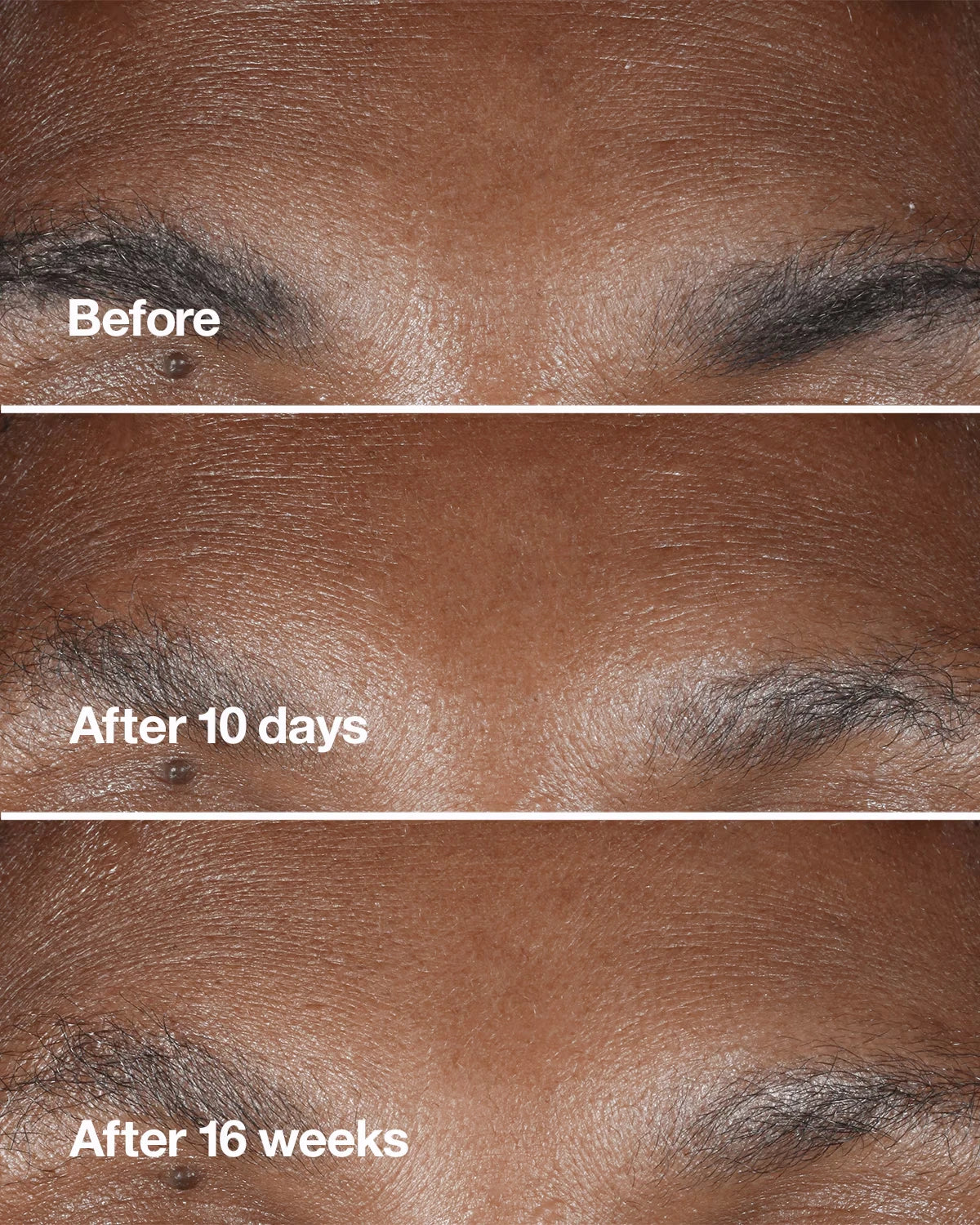 Clinique Smart Clinical Repair™ Wrinkle Correcting Serum - US 8116