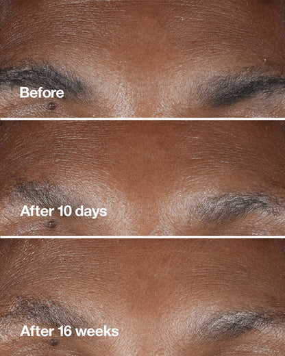 Clinique Smart Clinical Repair™ Wrinkle Correcting Serum - US 8116