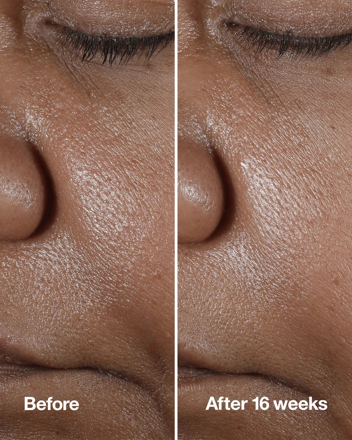 Clinique Smart Clinical Repair™ Wrinkle Correcting Serum - US 8116