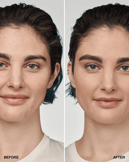 Even Better Clinical™ Serum Foundation Broad Spectrum SPF 25 - US 0656