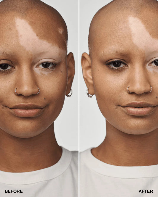 Even Better Clinical™ Serum Foundation Broad Spectrum SPF 25 - US 5975