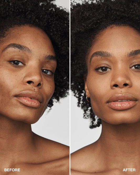 Even Better Clinical™ Serum Foundation Broad Spectrum SPF 25 - US 9932